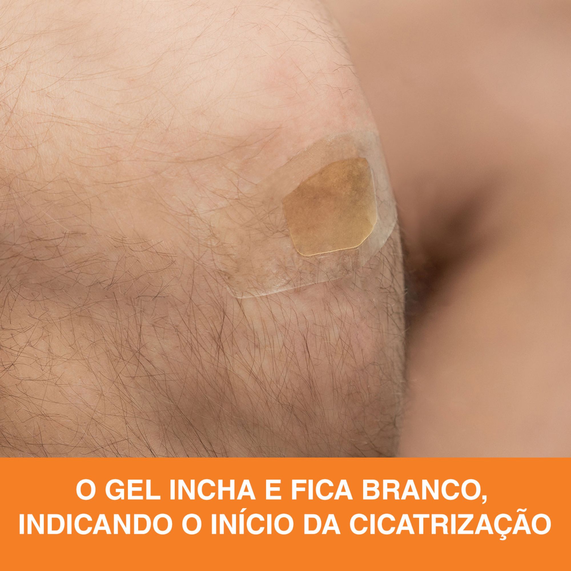 Curativo 3m Nexcare Cicatrização Avançada 6 Unidades - Imagem 7